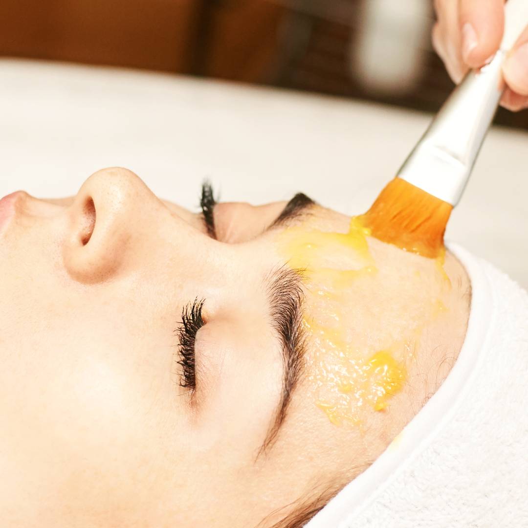 Are Chemical Peels Suitable for Sensitive Skin?