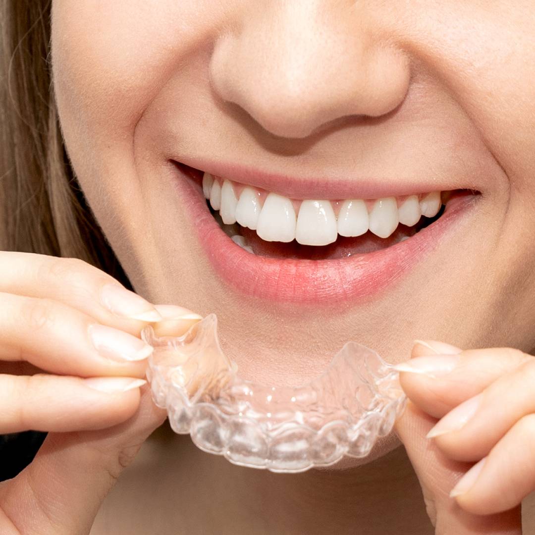 How Long Do I Need to Wear Angel Aligner Each Day?