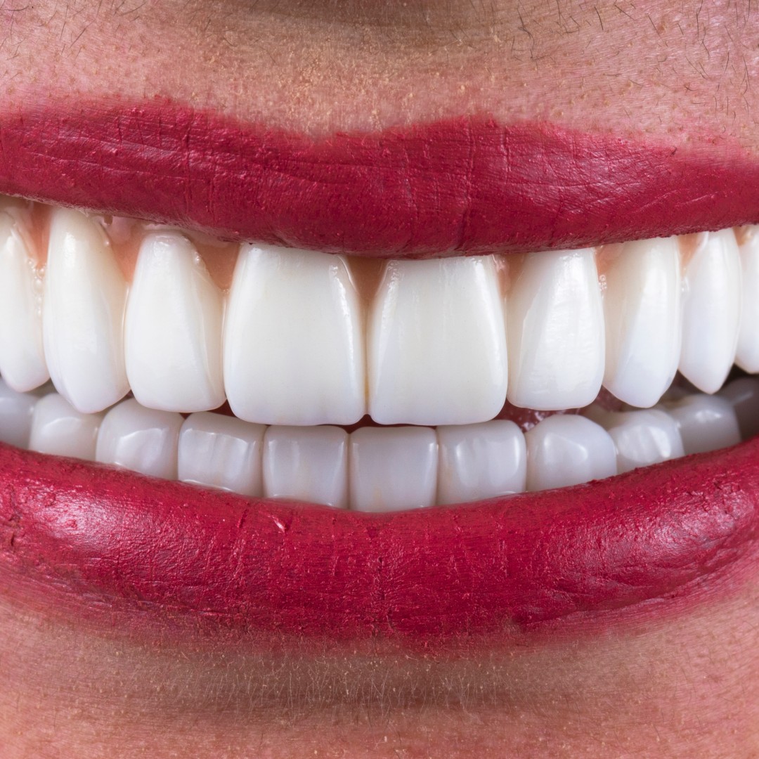 Can Dentures Be Adjusted for Better Comfort and Fit?