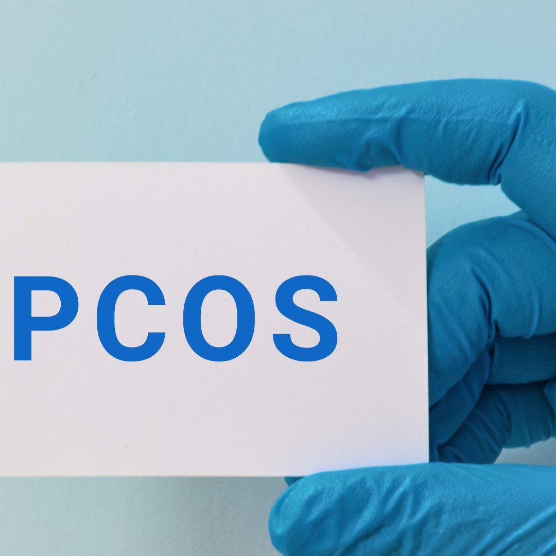 What Is the Link Between PCOS and Irregular Periods?