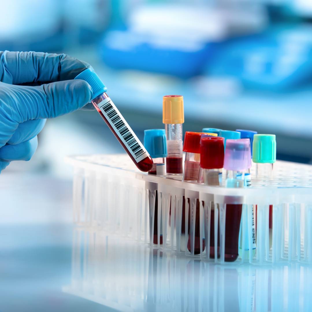 Can Laboratory Testing Identify Allergies?