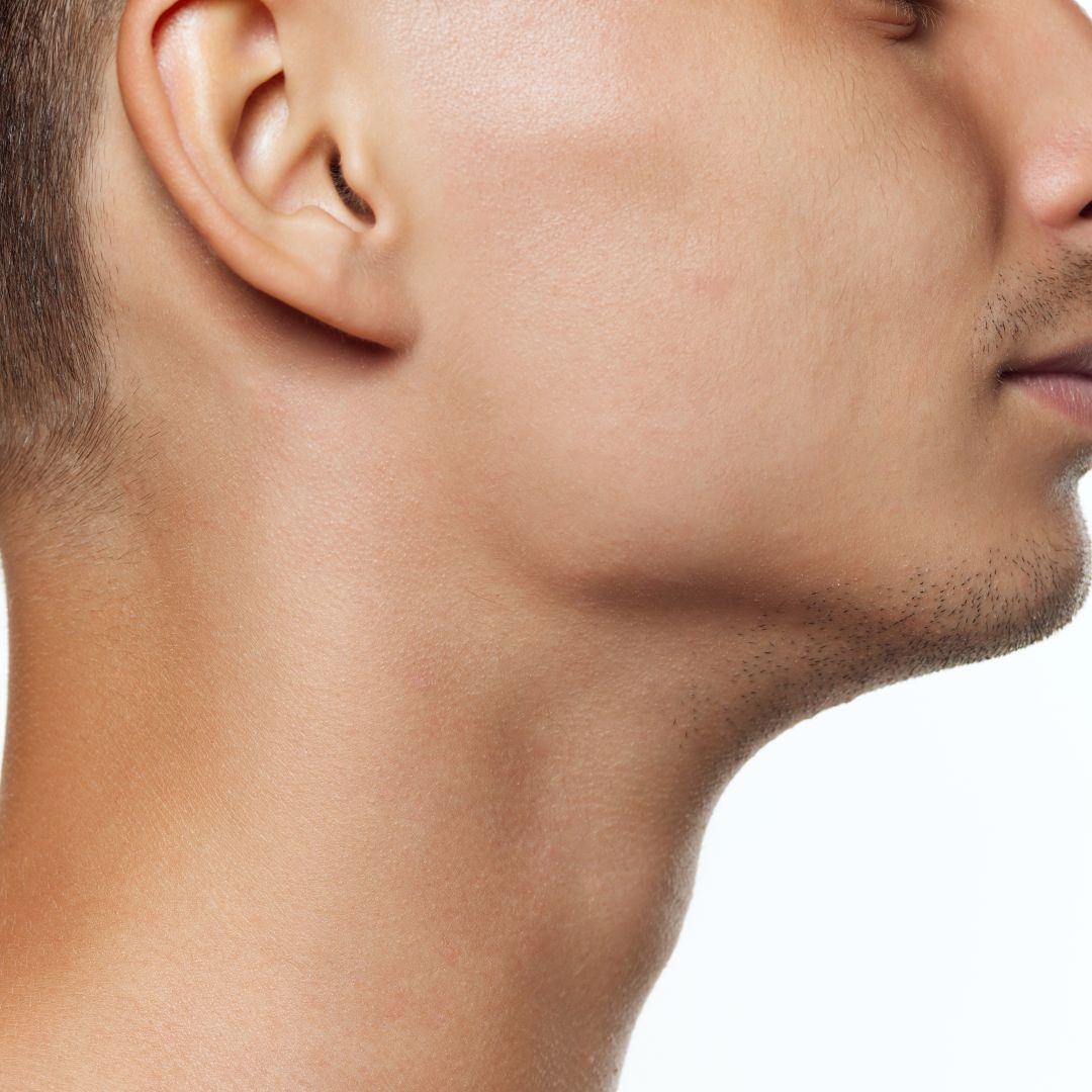 How Does Kybella Treatment Work to Reduce a Double Chin?