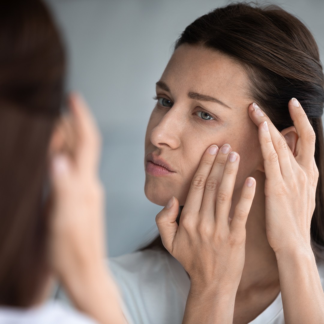 How Does Stress and Skin Problems Contribute to Acne?